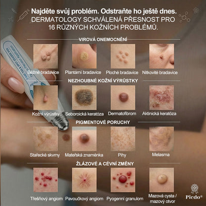 Oficiální značkový obchod |✅️👩‍⚕️𝐏𝐢𝒄𝒅𝒐® 7 dní Odstraňovač kožních skvrn a kožních výrůstků(Bezbolestný rollerball bez jizev)🌳